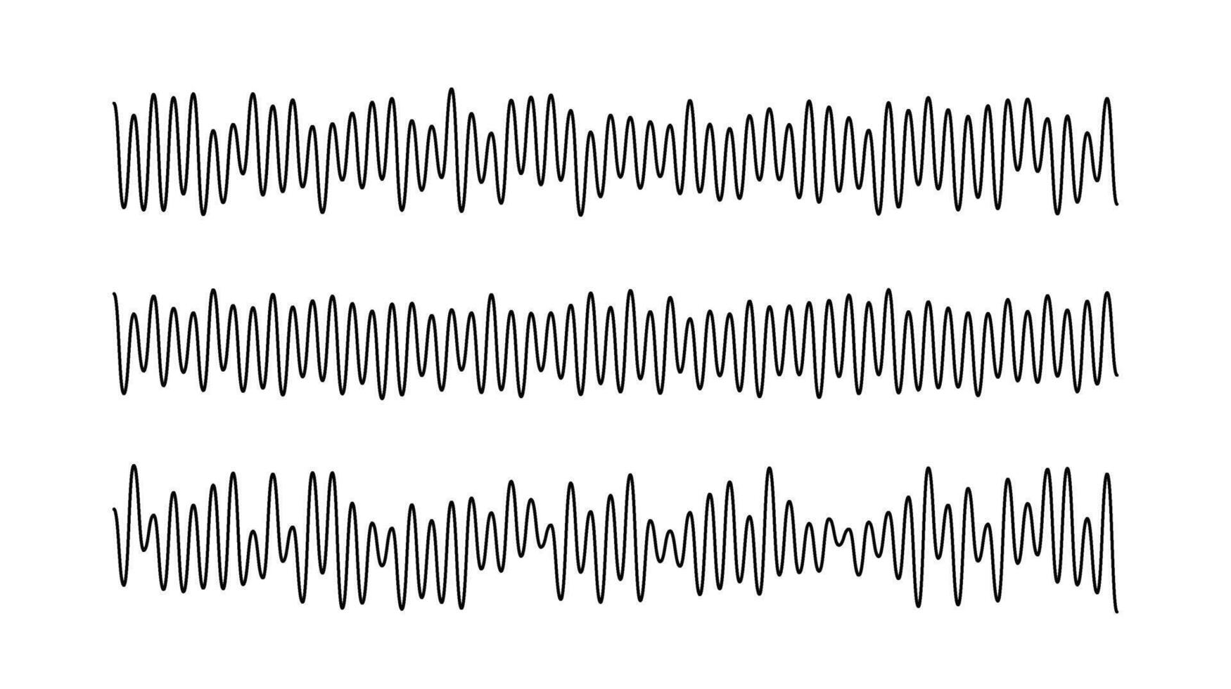 Sound wave signals set. Black audio track beats diagram collection. Voice or music sample concept. Pulse lines. Electronic radio graphics with different frequency and amplitude vector