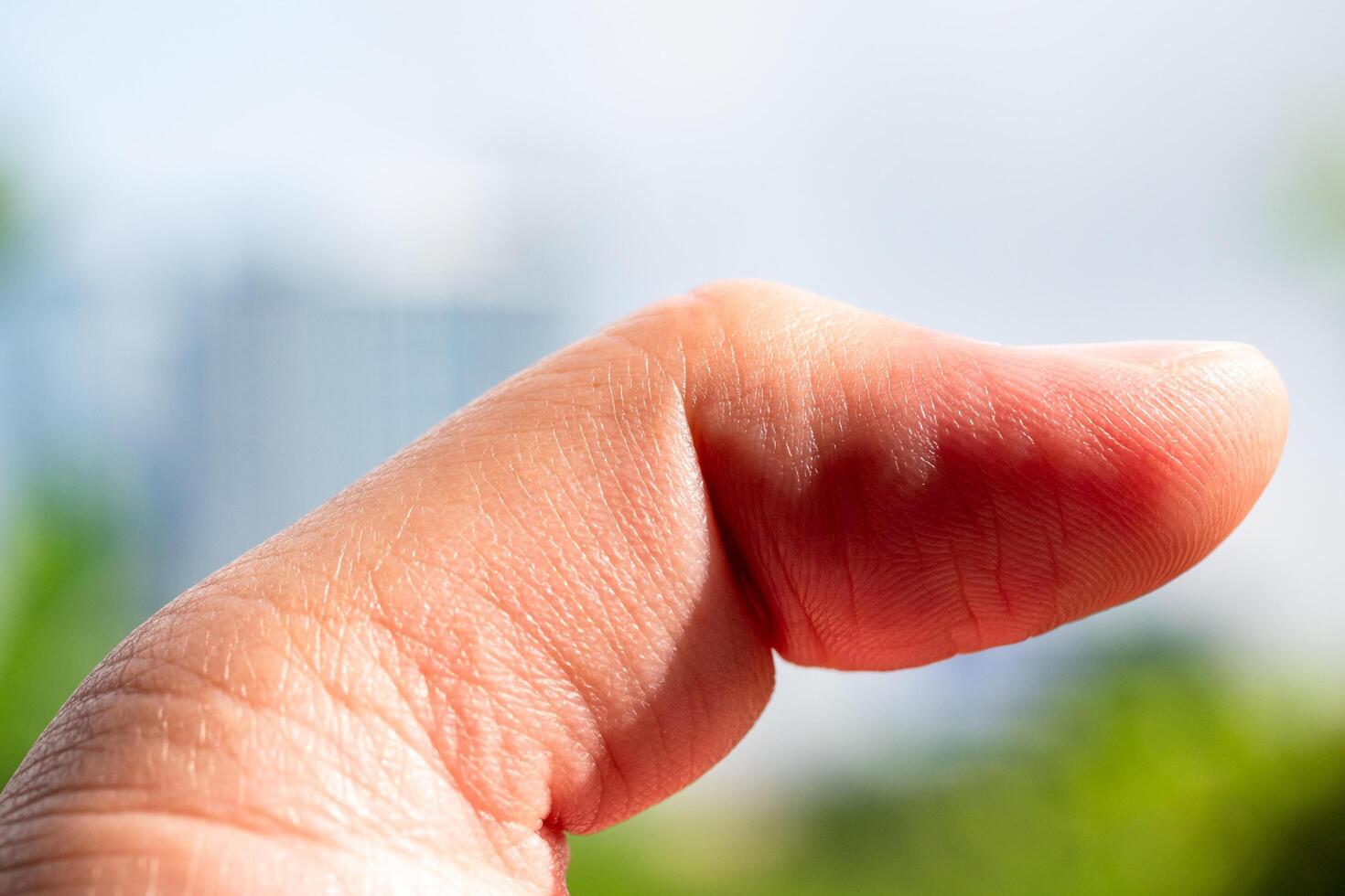 Focused view of hand gesture with thumb in nature expressing outdoor emotions photo