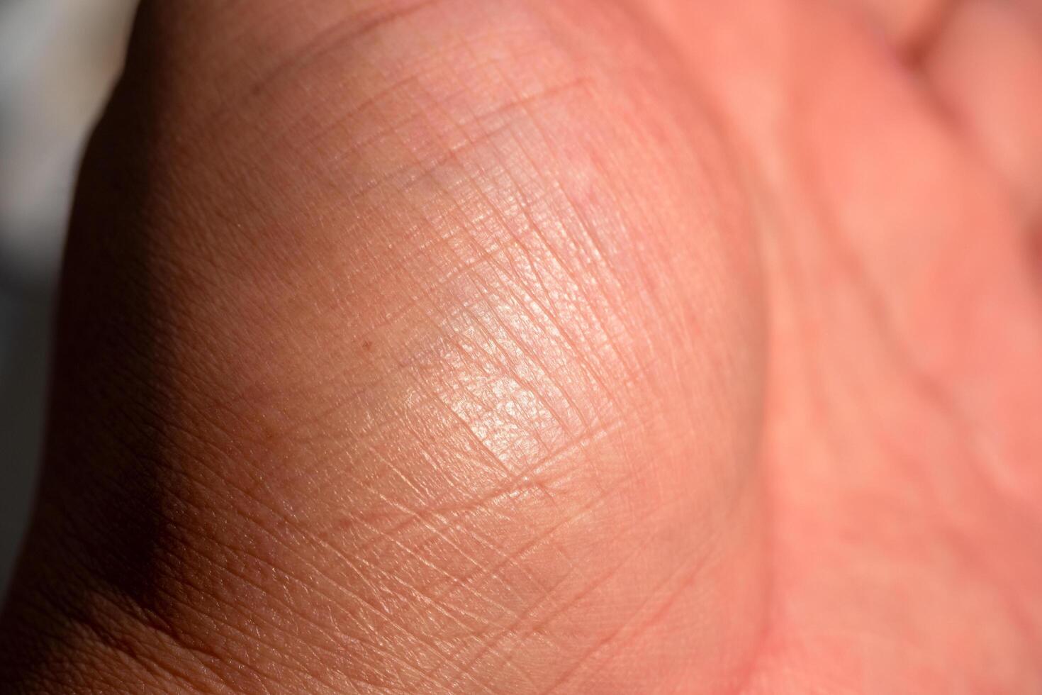Examining skin texture human palm macro indoor lighting close-up dermatology insights photo