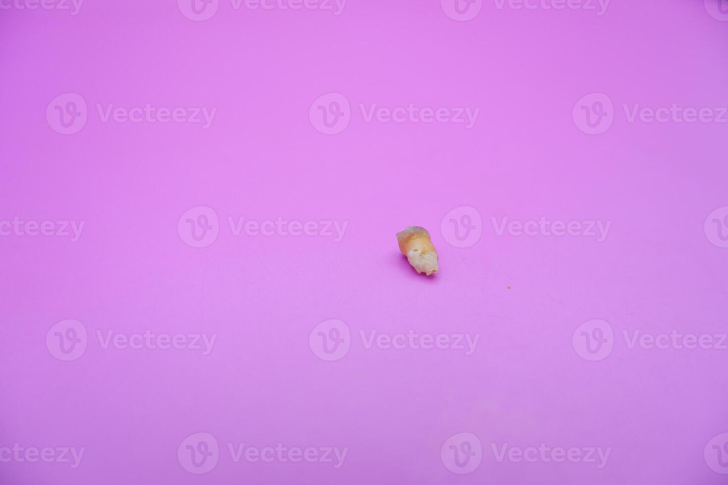 Removed Child Tooth with Severe Decay photo