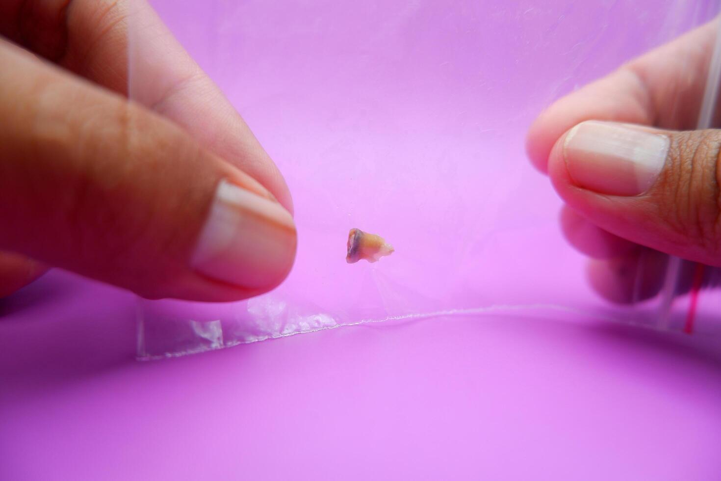Extracted Childs Tooth Stored in Plastic Bag photo