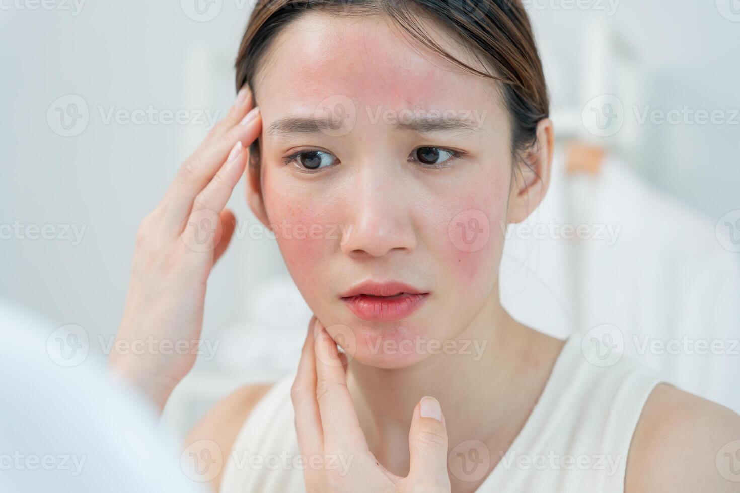 Woman worried about face Dermatology, rosacea dermatitis, allergic steroids, sensitive skin, red face from sunburn, acne, dry skin, large pores ,rash face, dull, freckles, wrinkle. photo