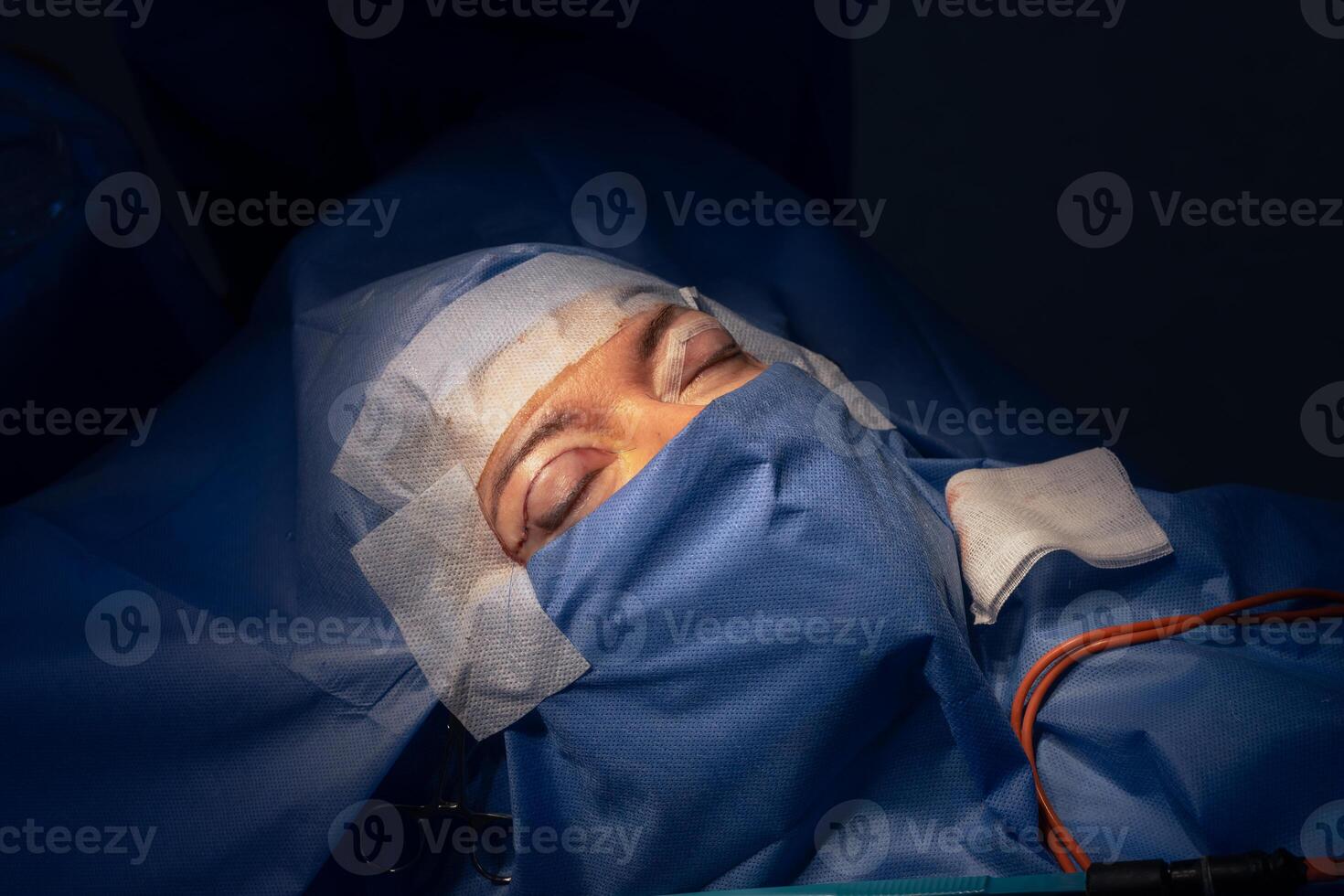 close-up eyes after eye surgery , blepharoplasty operation, plastic surgeon photo