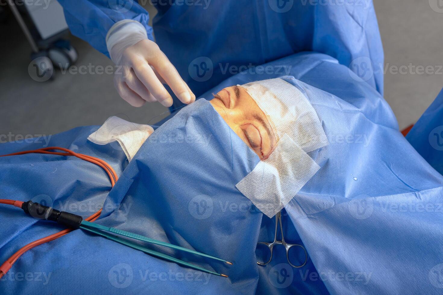 Eyelid Blepharoplasty Cosmetic Surgery Procedure in Clinic by Professional Medical Staff photo