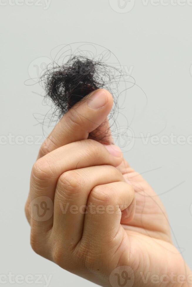 Woman with hair loss dry photo