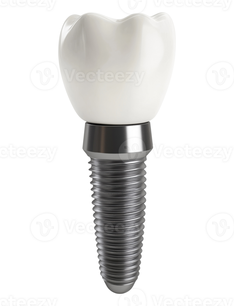 Dental implant model isolated on transparent background png