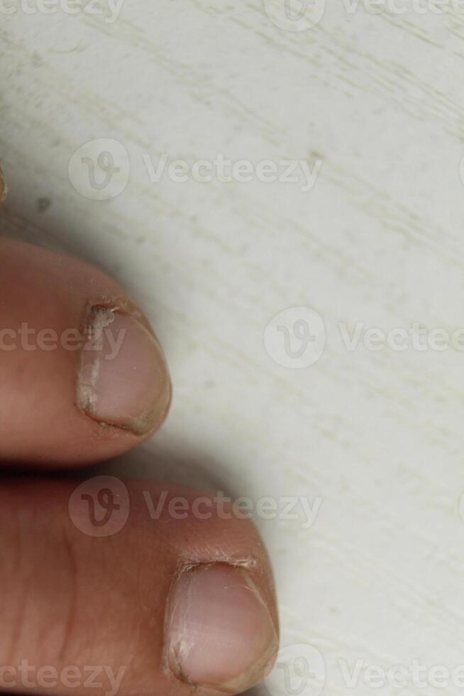 Close-up of the left leg of the alchi on a white background. Pinky is the ring middle toe photo