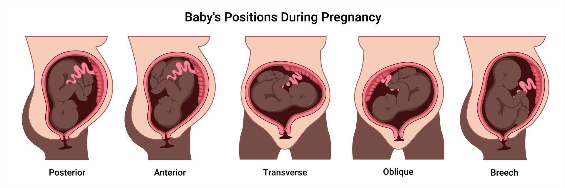 Baby positions during pregnancy illustrated vector
