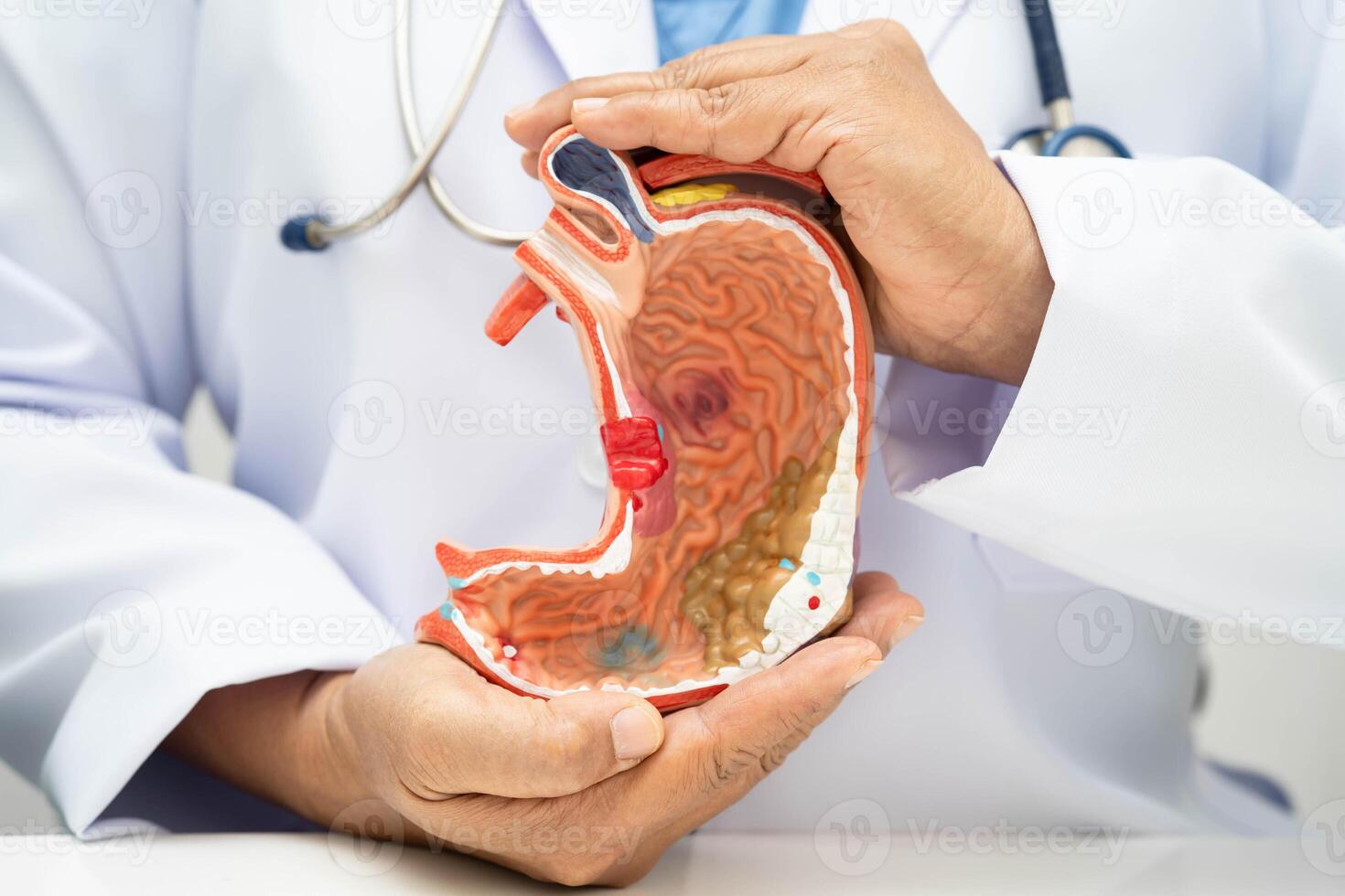 Stomach disease doctor holding anatomy model for study treatment photo