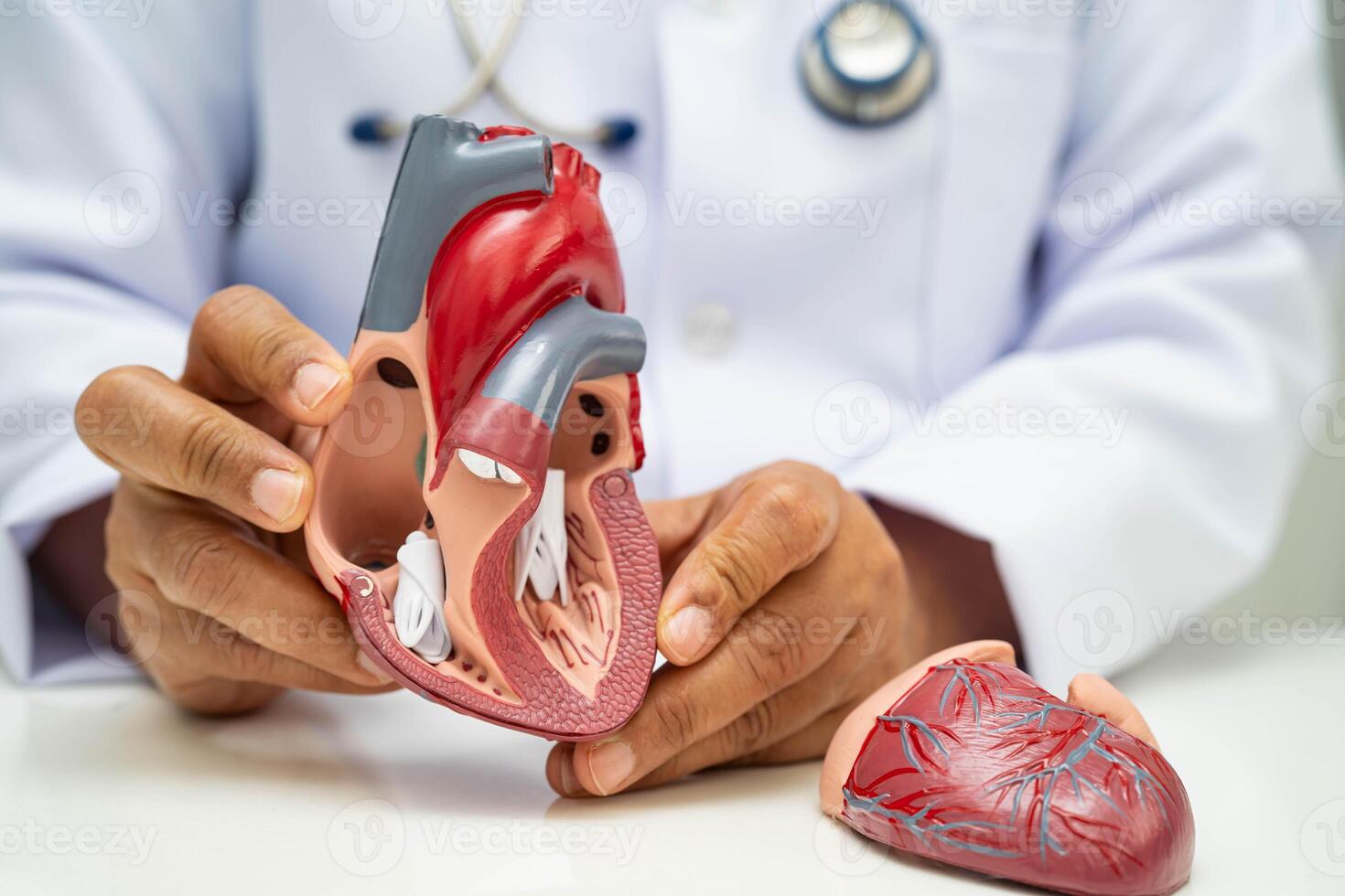 Cardiovascular disease CVD, doctor with heart human model anatomy patient photo