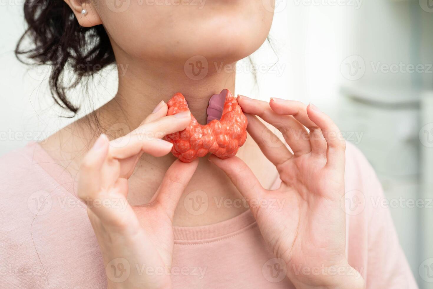 Hyperthyroidism Overactive Thyroid, Thyroid Lymphoma, Asian woman with thyroid gland anatomy photo