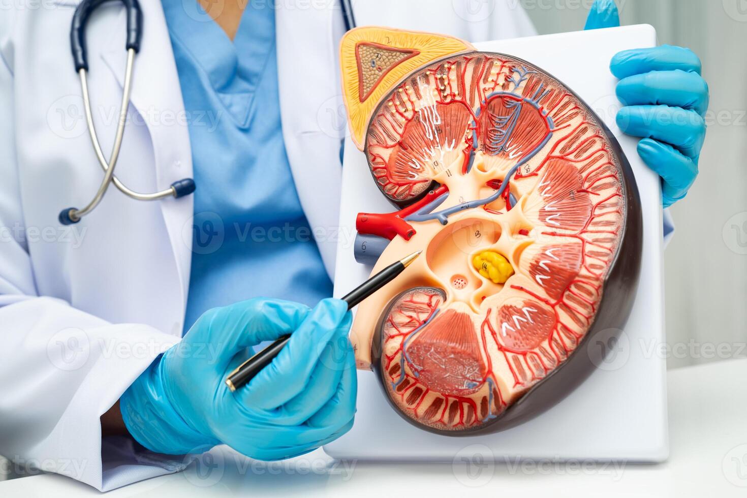 Chronic kidney disease doctor with model for treatment urinary urology, Estimated glomerular filtration rate eGFR. photo