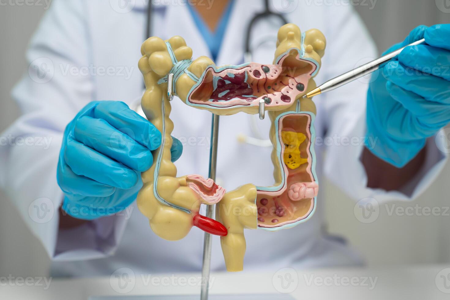Intestine doctor holding human anatomy model for study photo