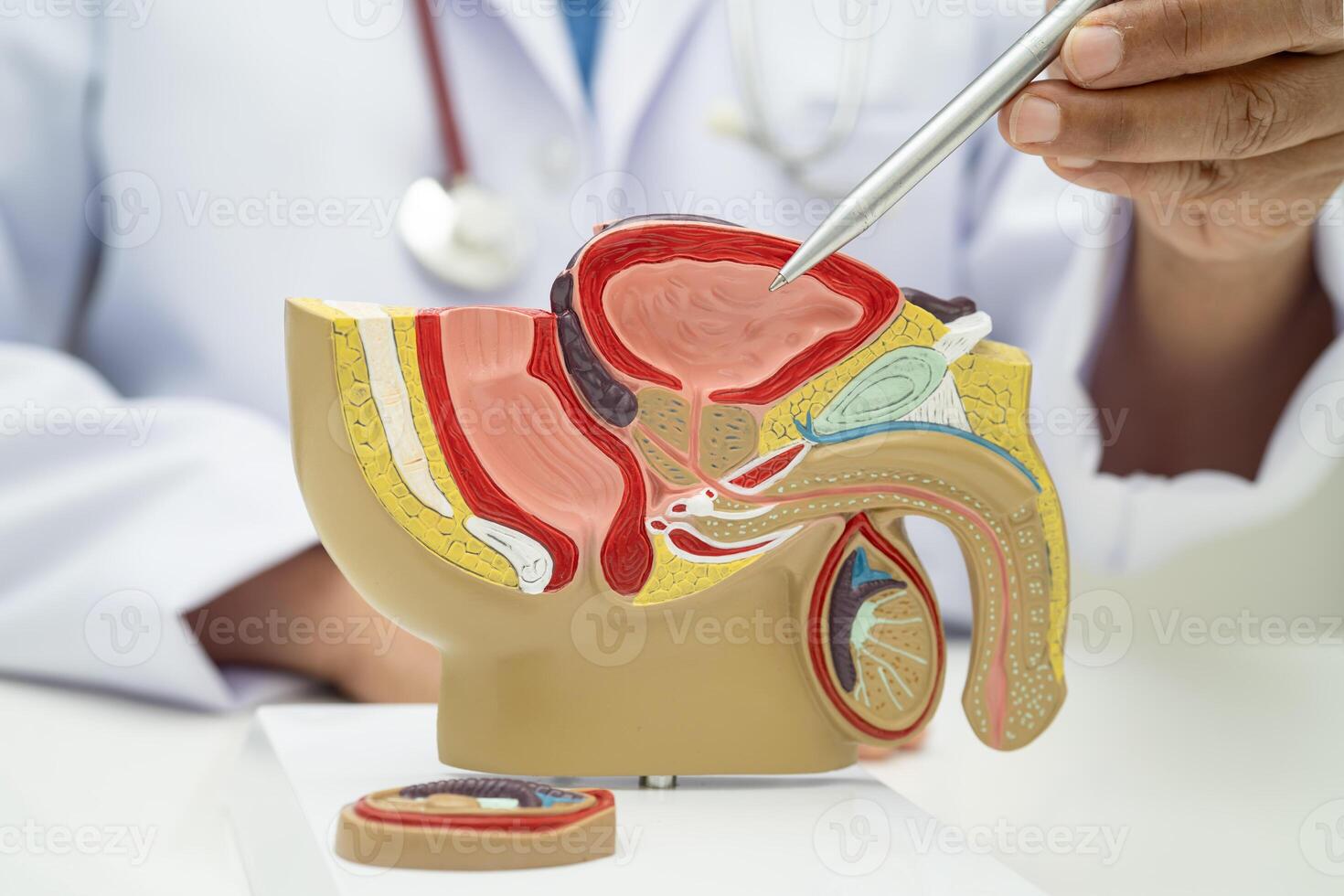 Male reproductive system, Asian doctor holding human anatomy model for study diagnosis treatment in hospital. photo