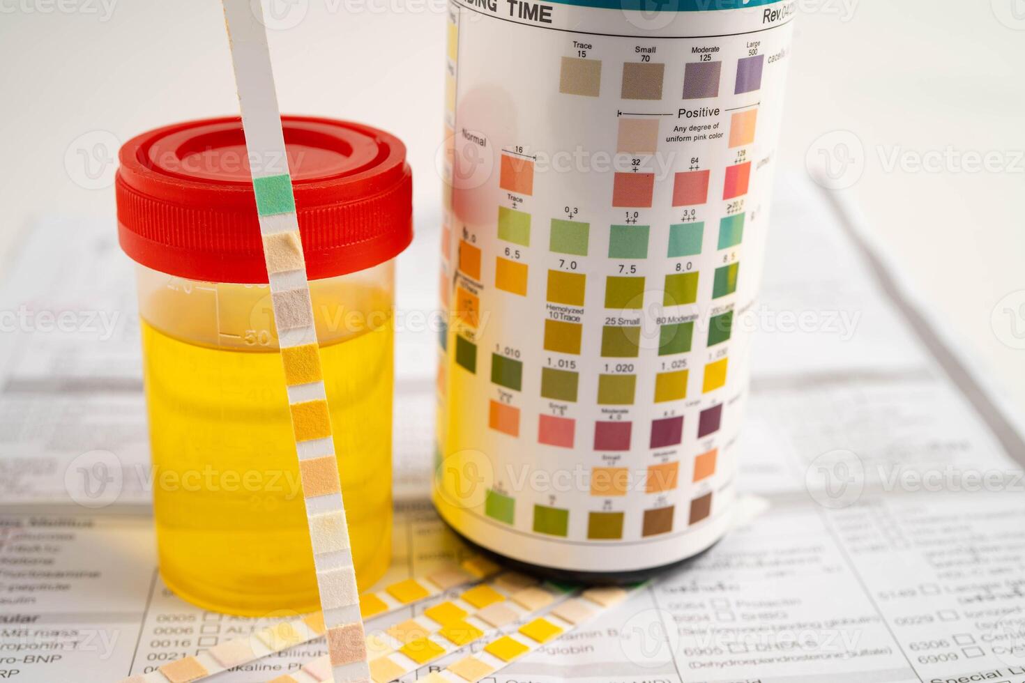 Urinalysis, urine cup with reagent strip pH paper test and comparison chart photo