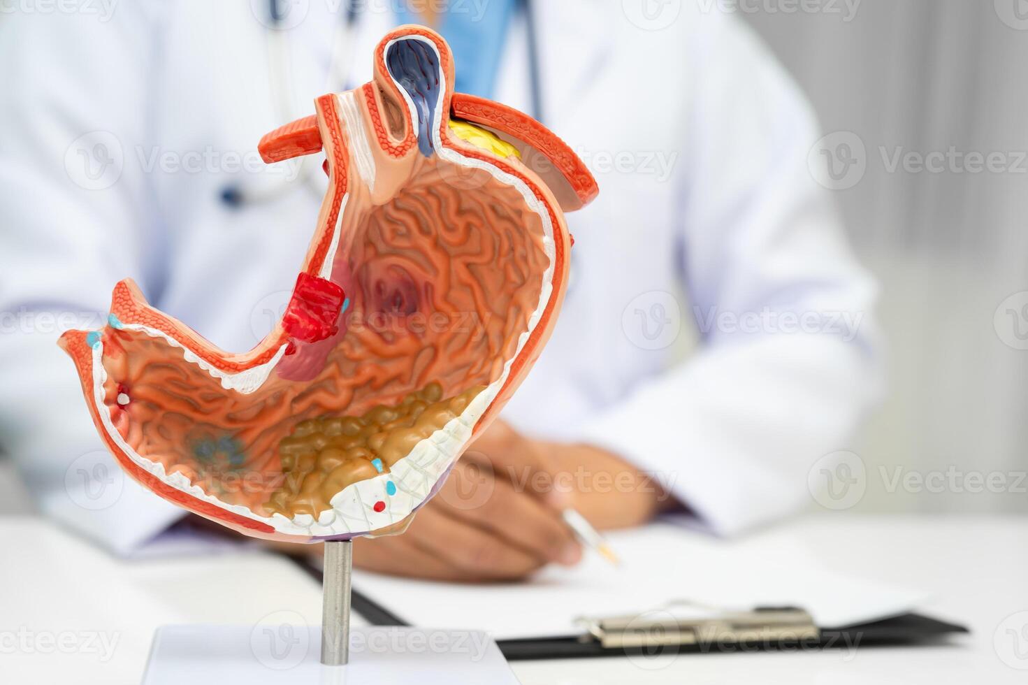 Stomach disease, doctor holding anatomy model for study diagnosis and treatment in hospital. photo
