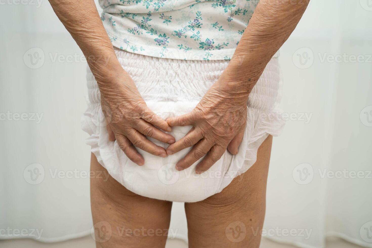 woman patient wearing adult incontinence diaper pad in hospital. photo