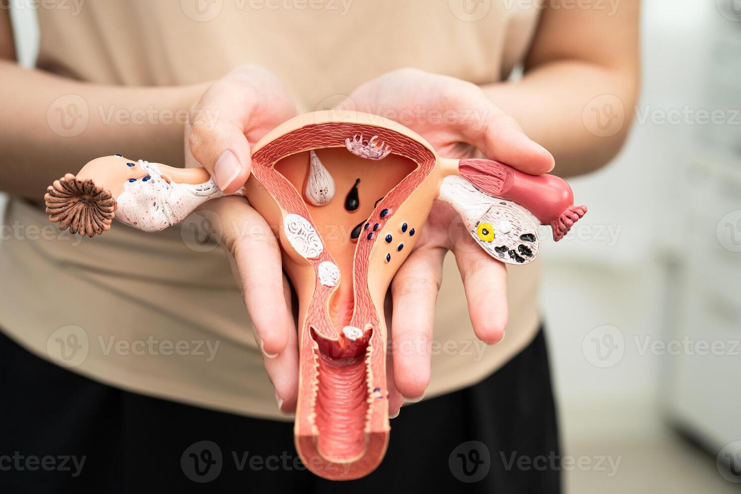 Uterus woman human anatomy model. photo