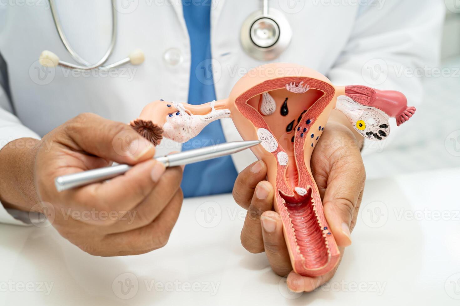 Uterus doctor anatomy model for study diagnosis and treatment in hospital. photo