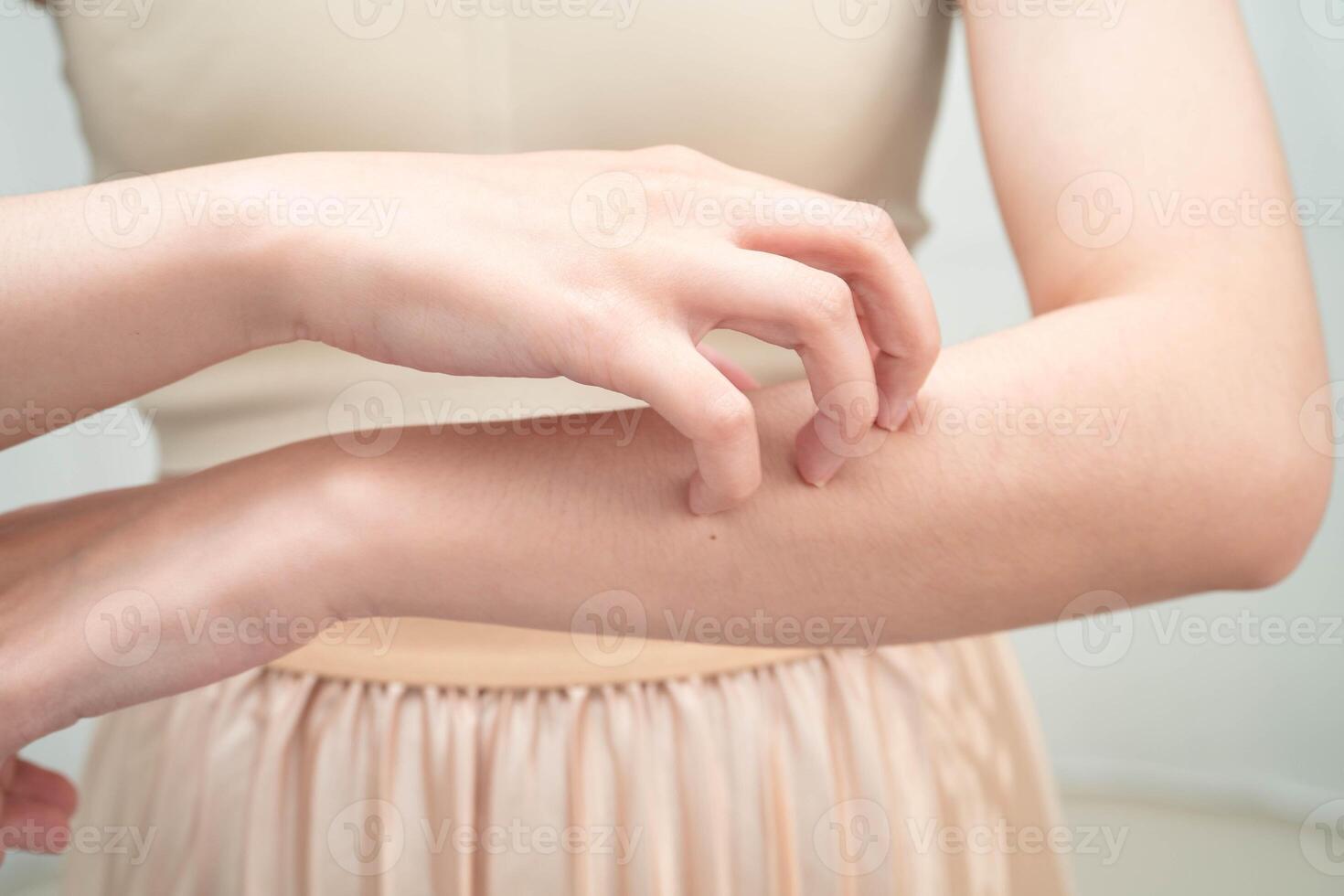 Asian woman itching of skin diseases using hand scratching. photo