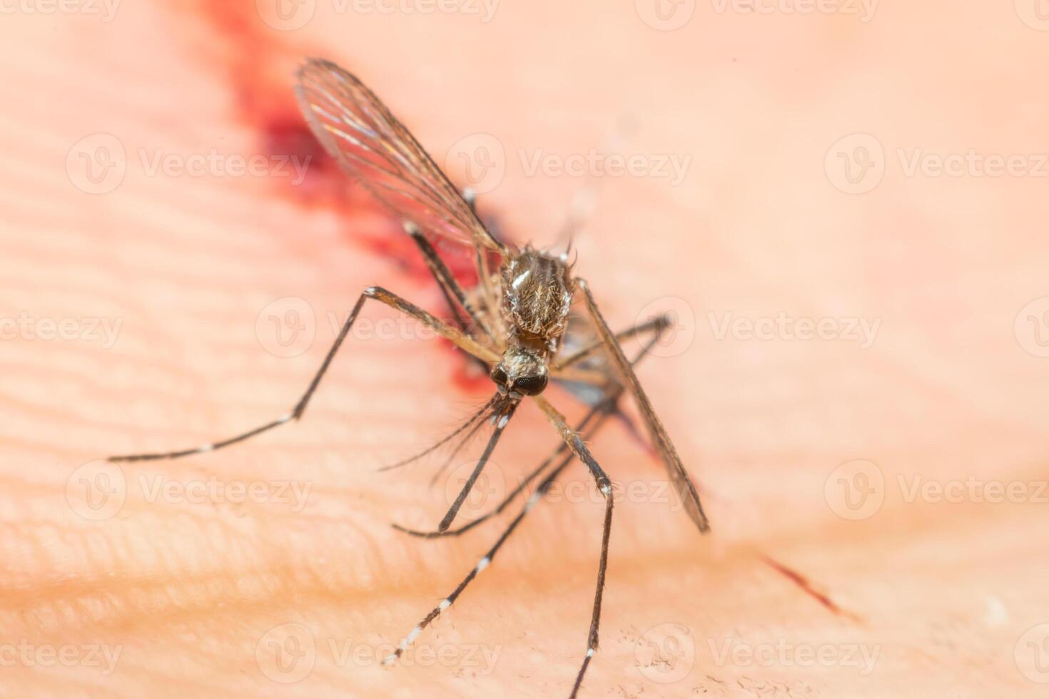 A mosquito bites a person's hand photo