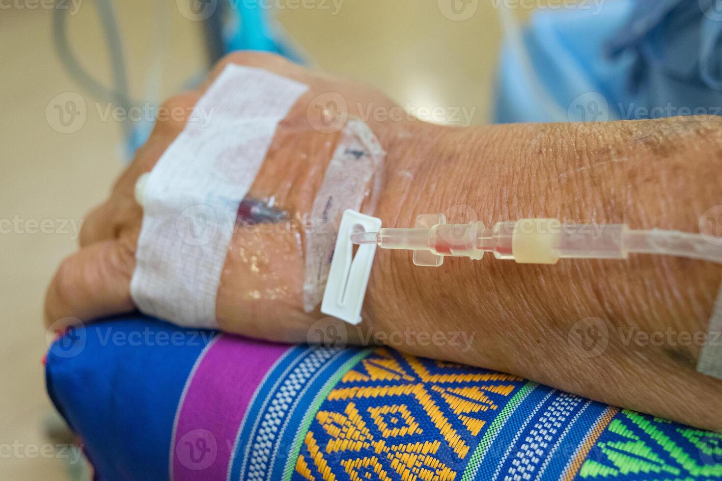 A person with an iv drip on their arm photo
