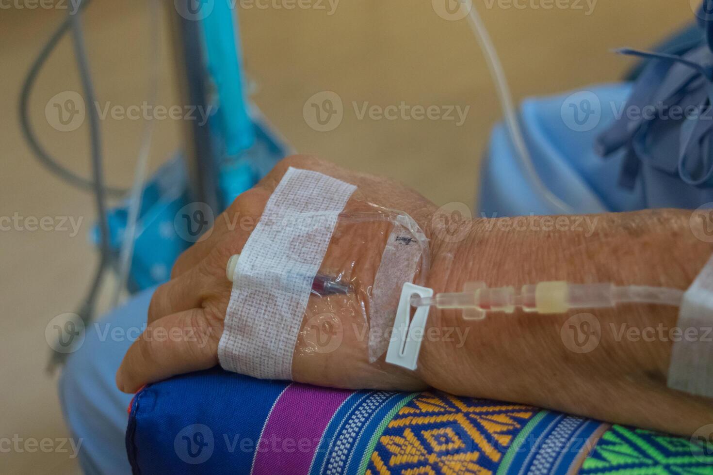 A person with an iv in their arm photo