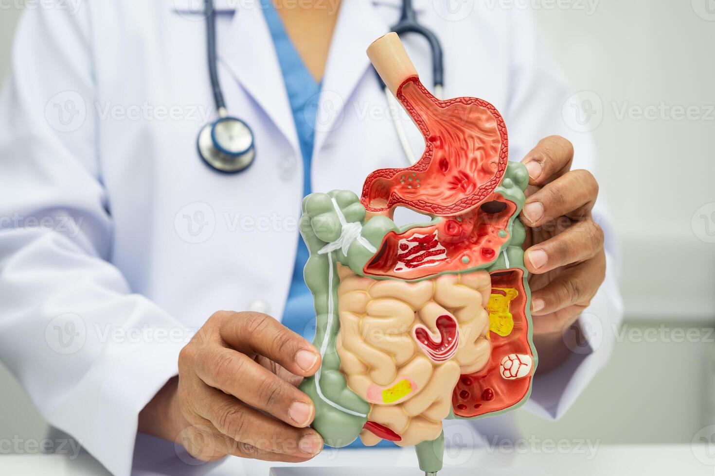 Digestive system with stomach and intestine, Asian doctor holding human anatomy model diagnosis photo