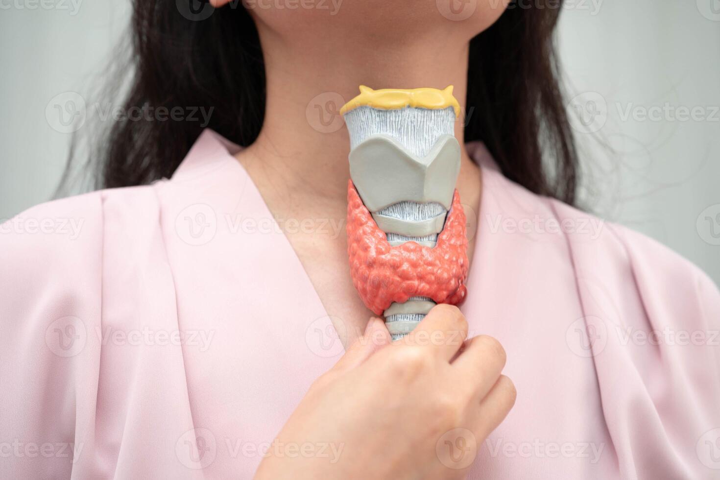 Hyperthyroidism Overactive Thyroid, Thyroid Lymphoma, Asian woman thyroid gland human photo
