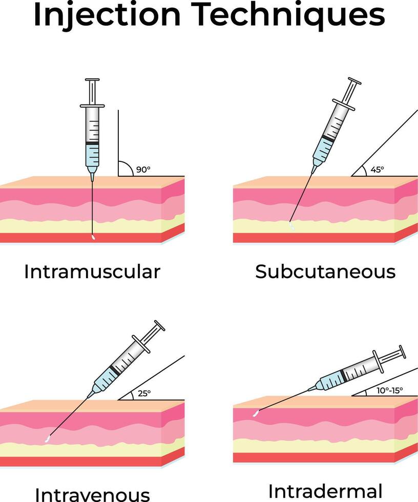 Different Injection Techniques Intramuscular Subcutaneous Intravenous and Intradermal vector