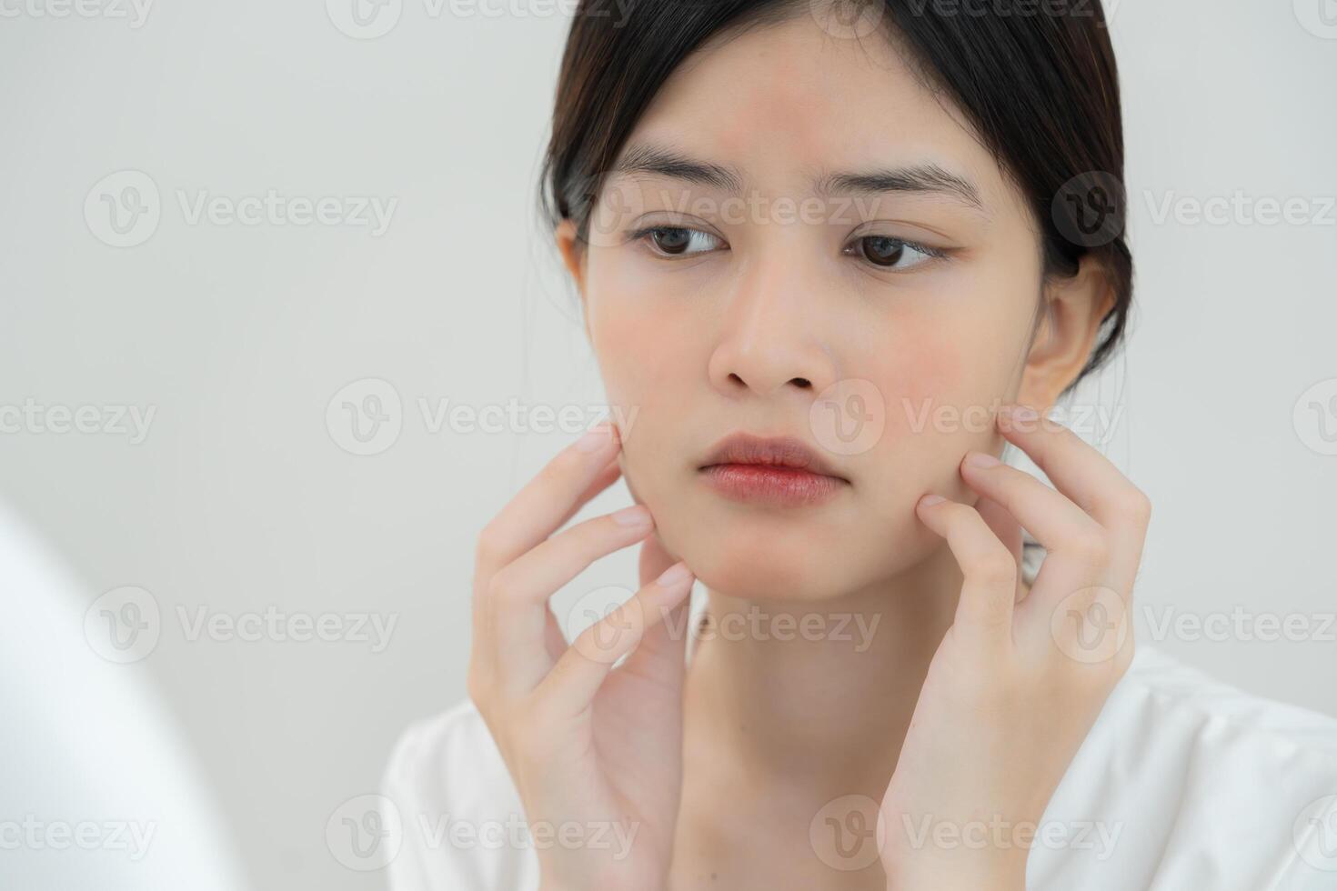 Woman worried about face Dermatology, rosacea dermatitis, allergic steroids, sensitive skin, red face from sunburn, acne, dry skin, large pores ,rash face, dull, freckles photo