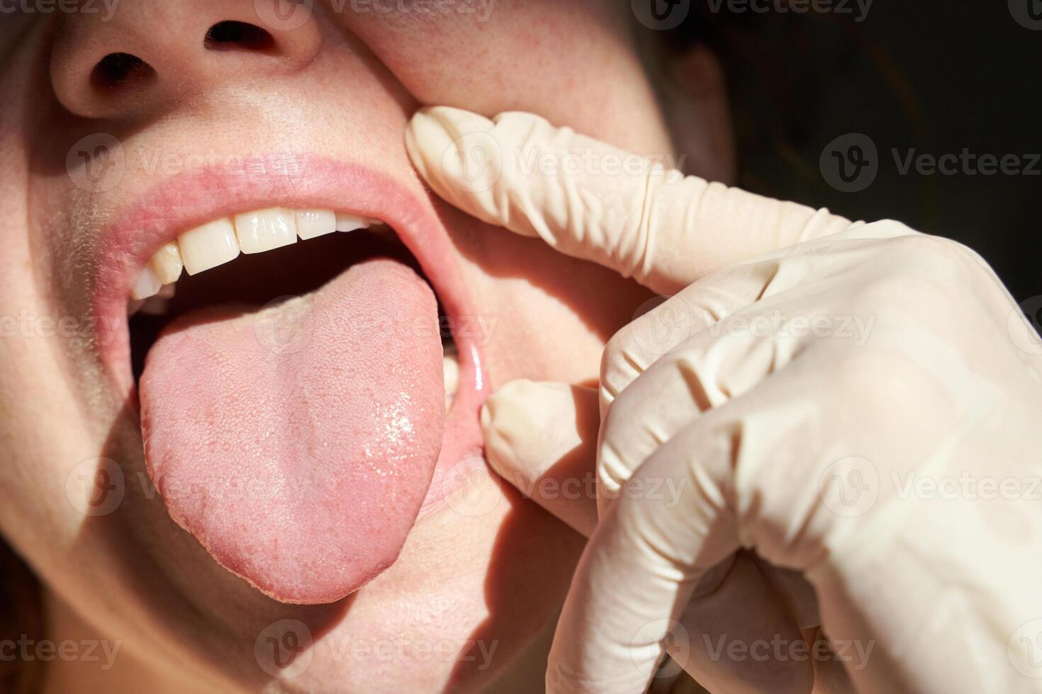 Close-up of female mouth with tongue out and gloved hand examining inside oral health check. photo