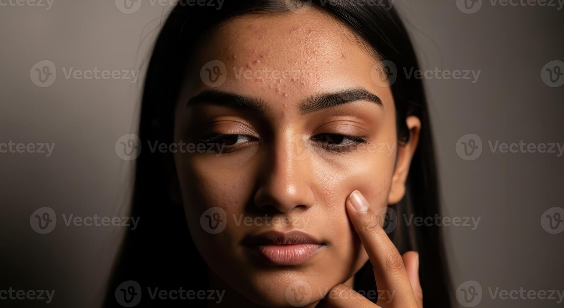 Close up portrait of a young woman with visible acne on her forehead and cheeks photo