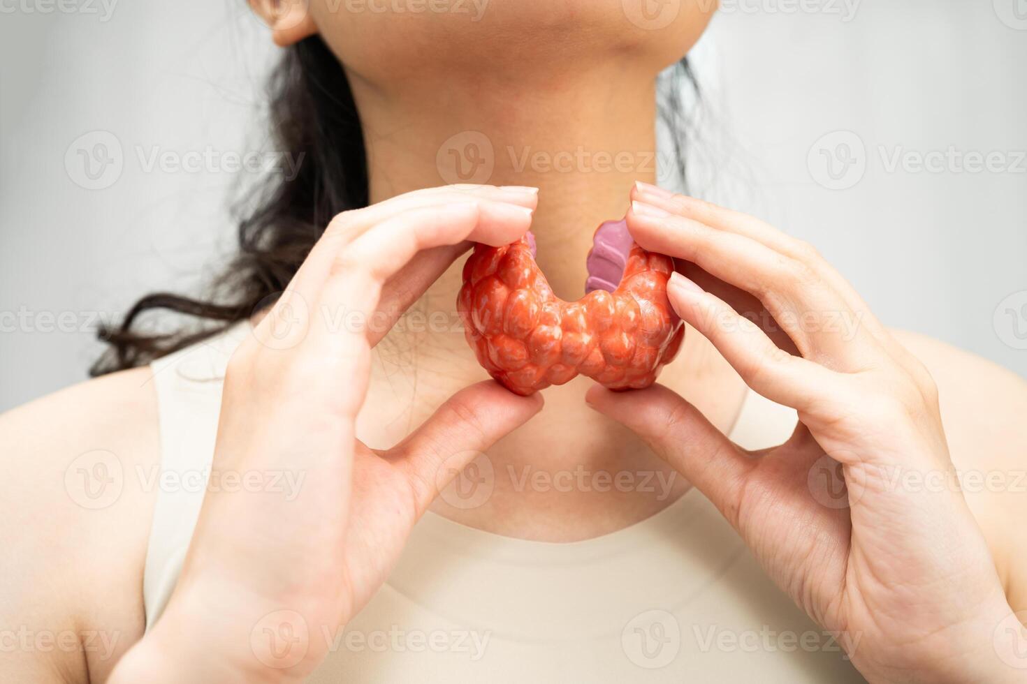 Hyperthyroidism, Overactive Thyroid, Thyroid Lymphoma, Asian woman with thyroid gland human anatomy model. photo