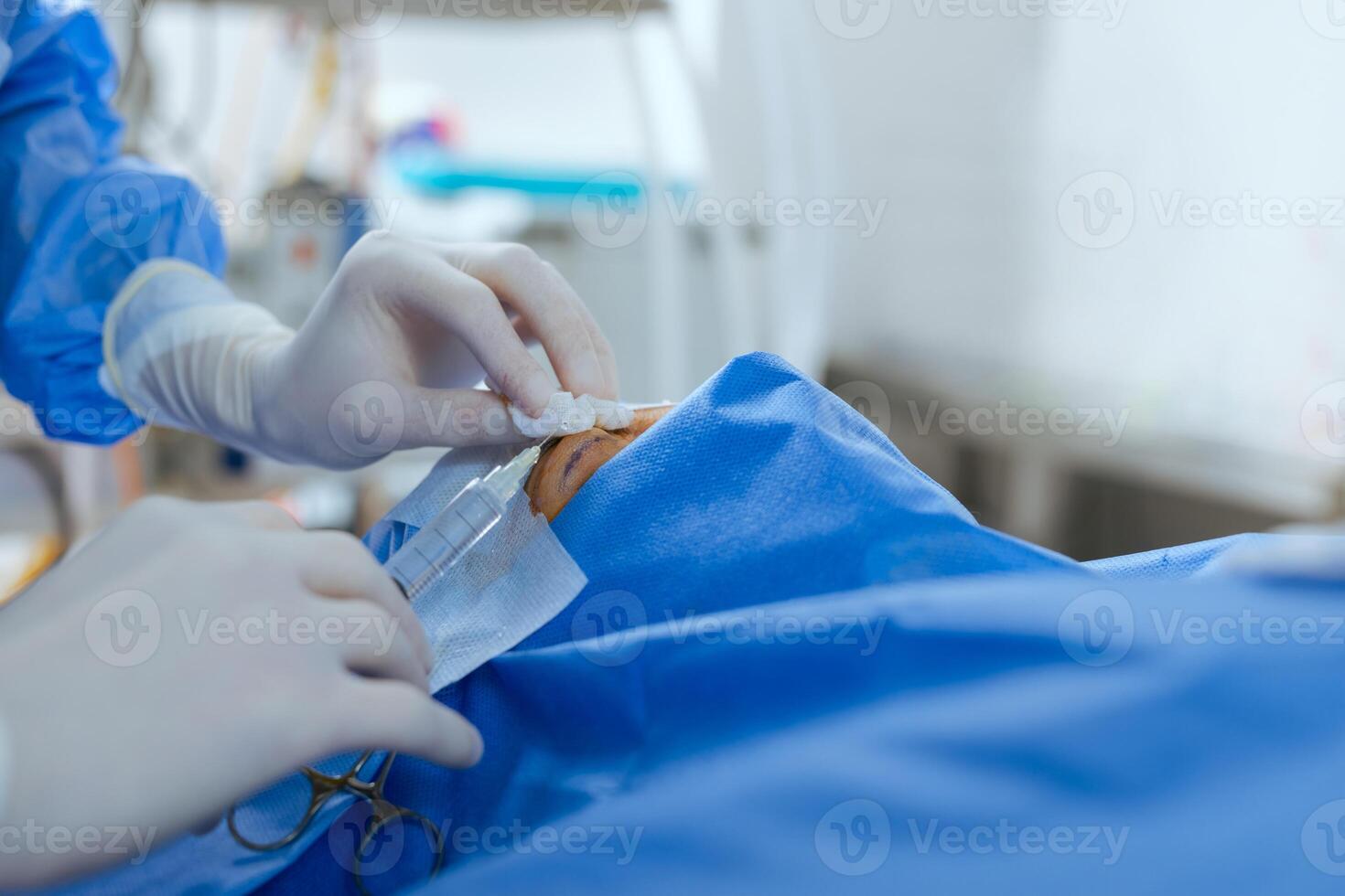 Blepharoplasty, plastic surgery operation for correcting defects, deformities, and disfigurations of the eyelids plastic surgery. photo