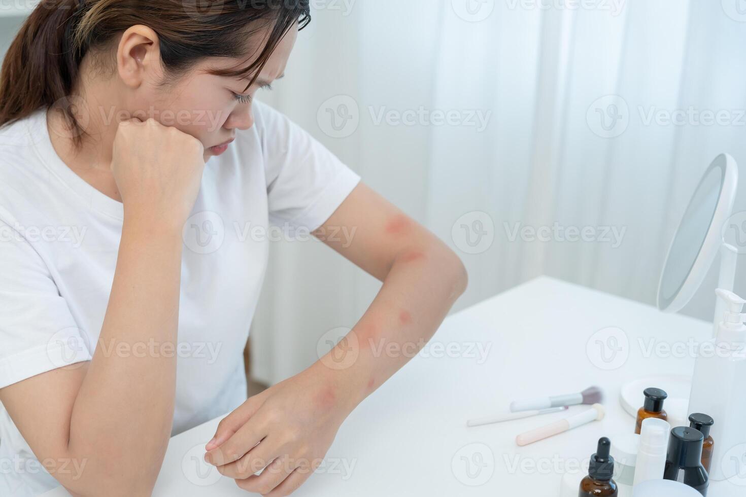 skin problem and beauty, Young woman scratch body has itchy skin from skin allergic, steroid allergy, sensitive skin, red from sunburn, chemical allergy, rash, insect bites, Seborrheic Dermatitis, photo