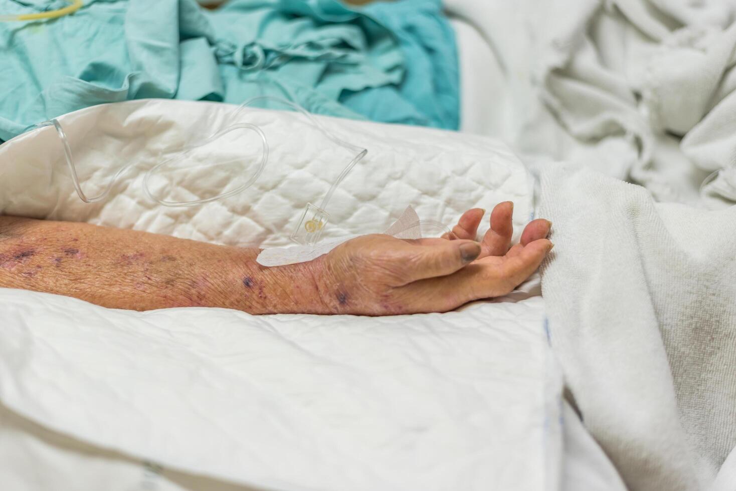A hand with a bandage on it is laying in a hospital bed photo