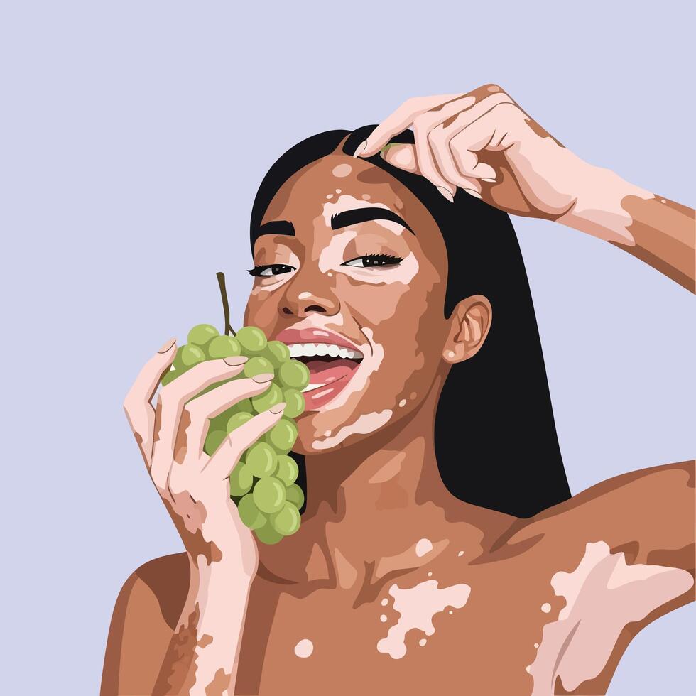 Smiling Woman with Vitiligo Eating Green Grapes on Light Purple Background vector