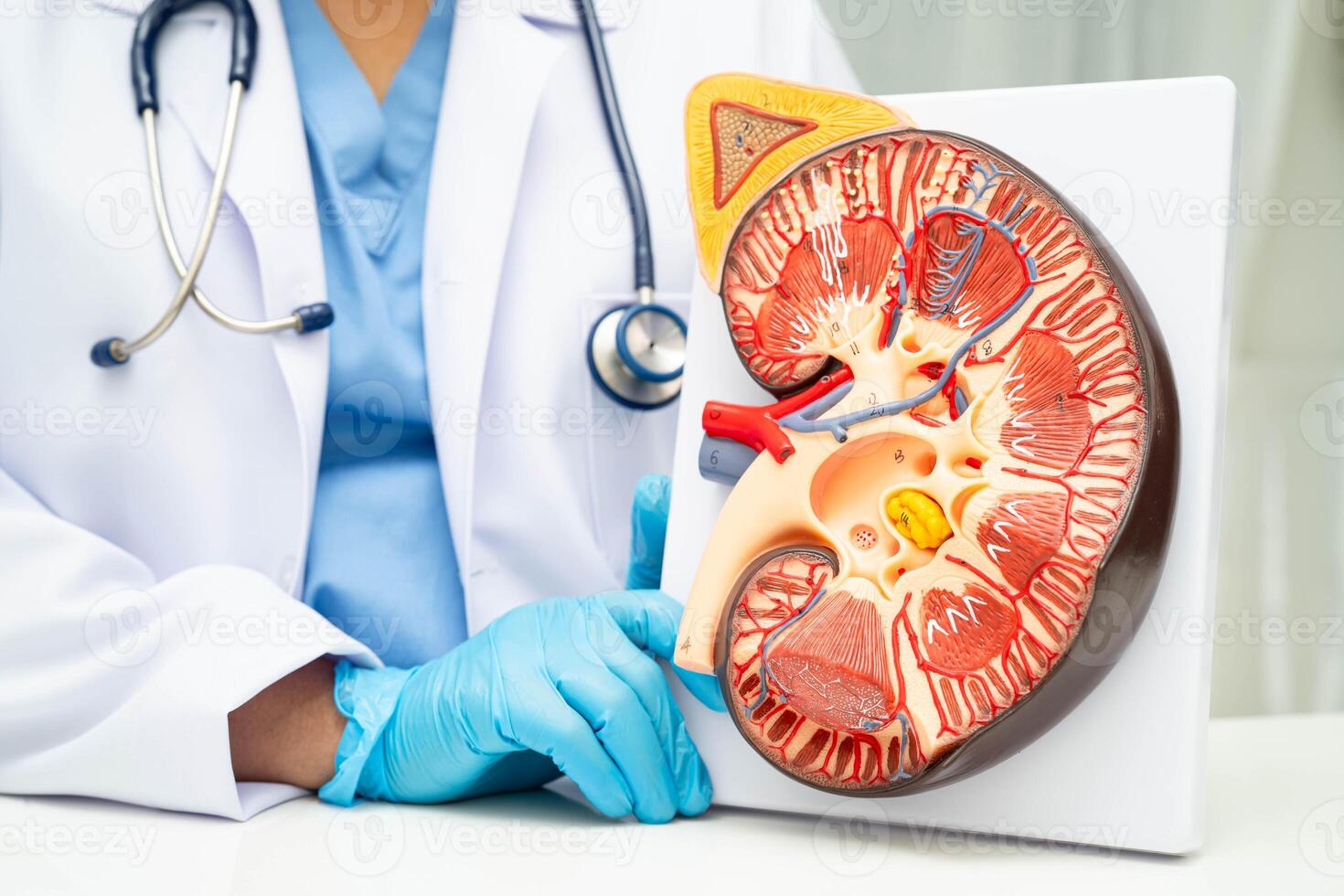 Chronic kidney disease, doctor with model for treatment urinary system, urology, Estimated rate eGFR. photo