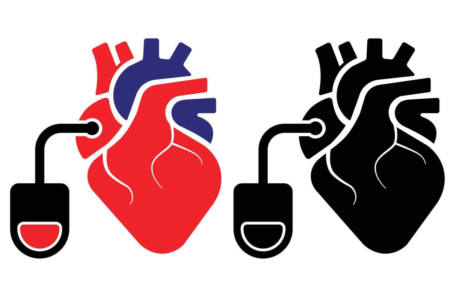 Heart Pacemaker Medical Illustration, Cardiac Implant Device for Anatomy and Education vector
