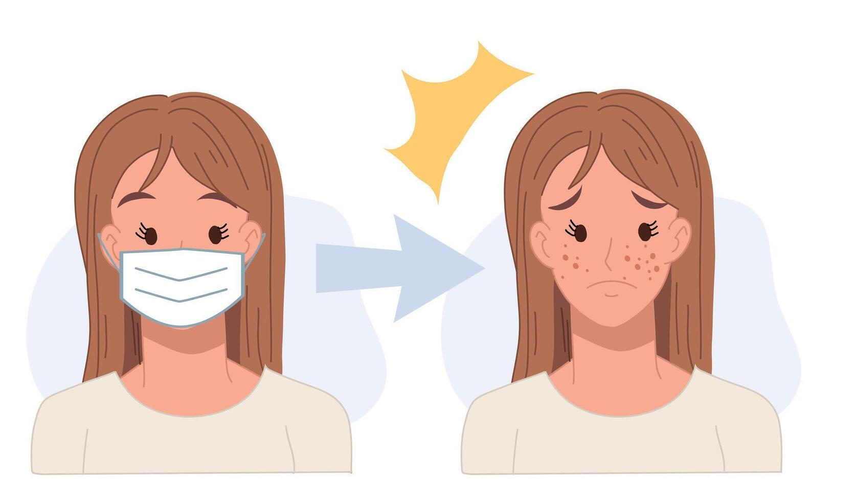Acne caused wearing face mask.acne concept.pimples. skin problems .Flat cartoon character illustration. vector