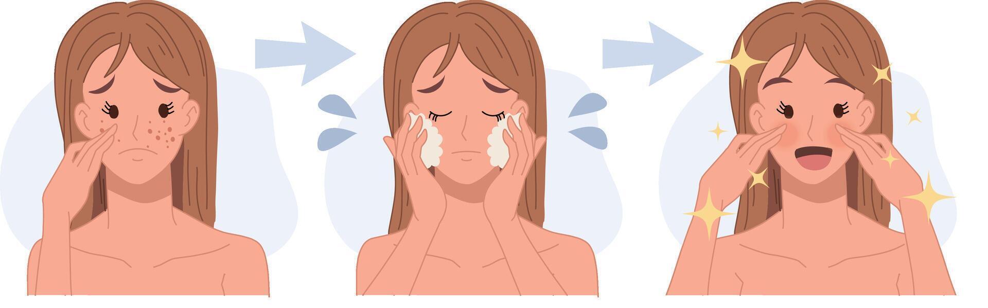 treat acne,skin problem,pimple .woman face.Beautiful.before after,step cleansing face. Flat 2d cartoon character illustration. vector