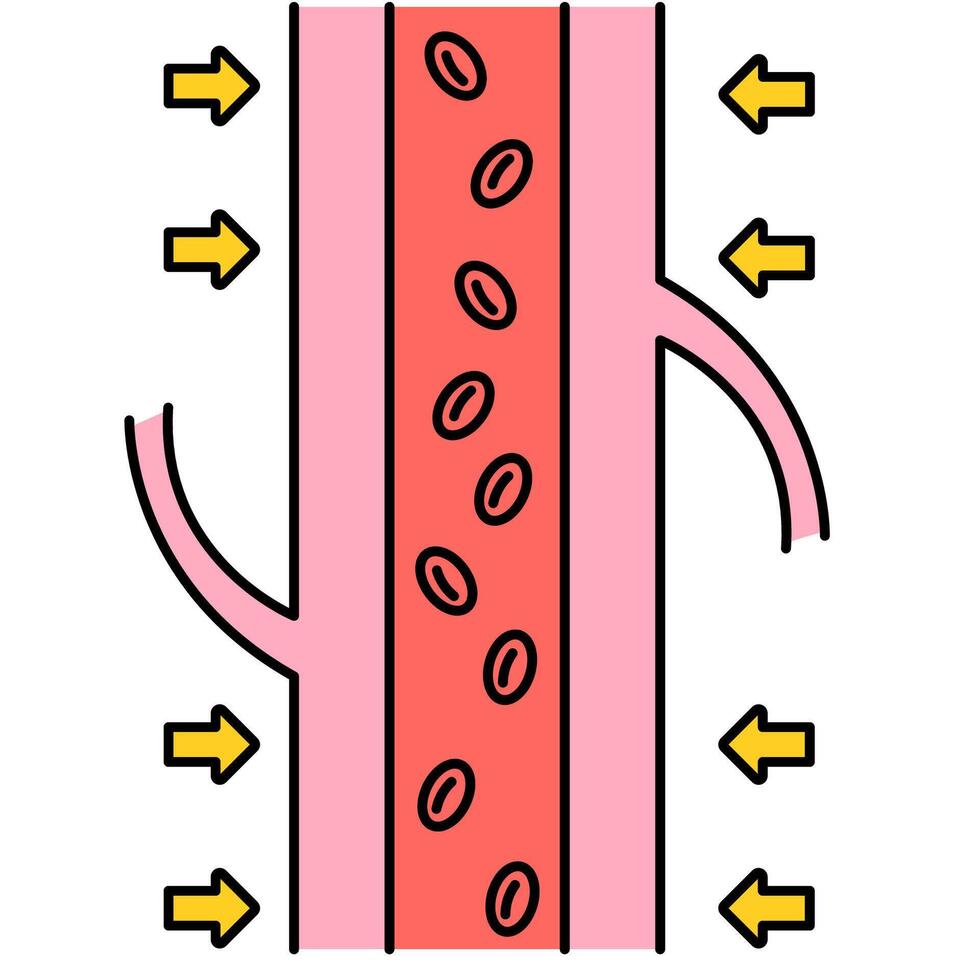 Artery Constriction Diagram vector