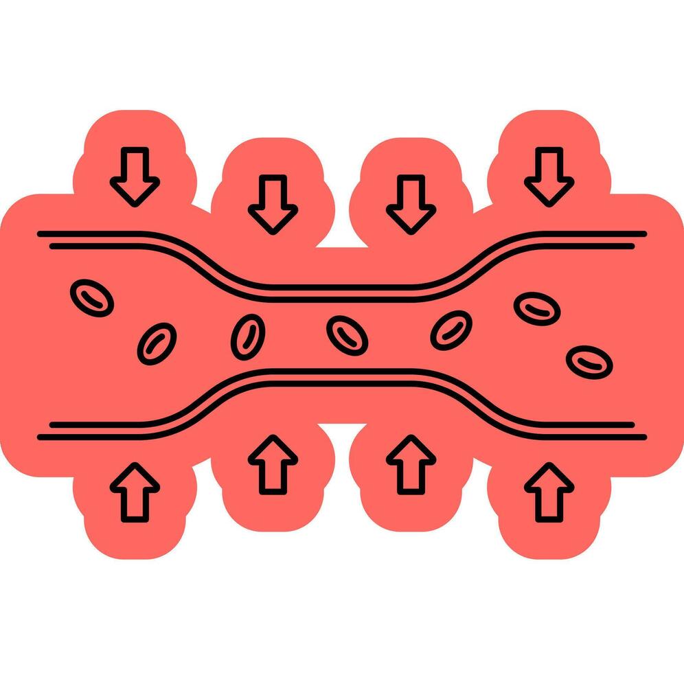Narrowing Artery Symbol vector