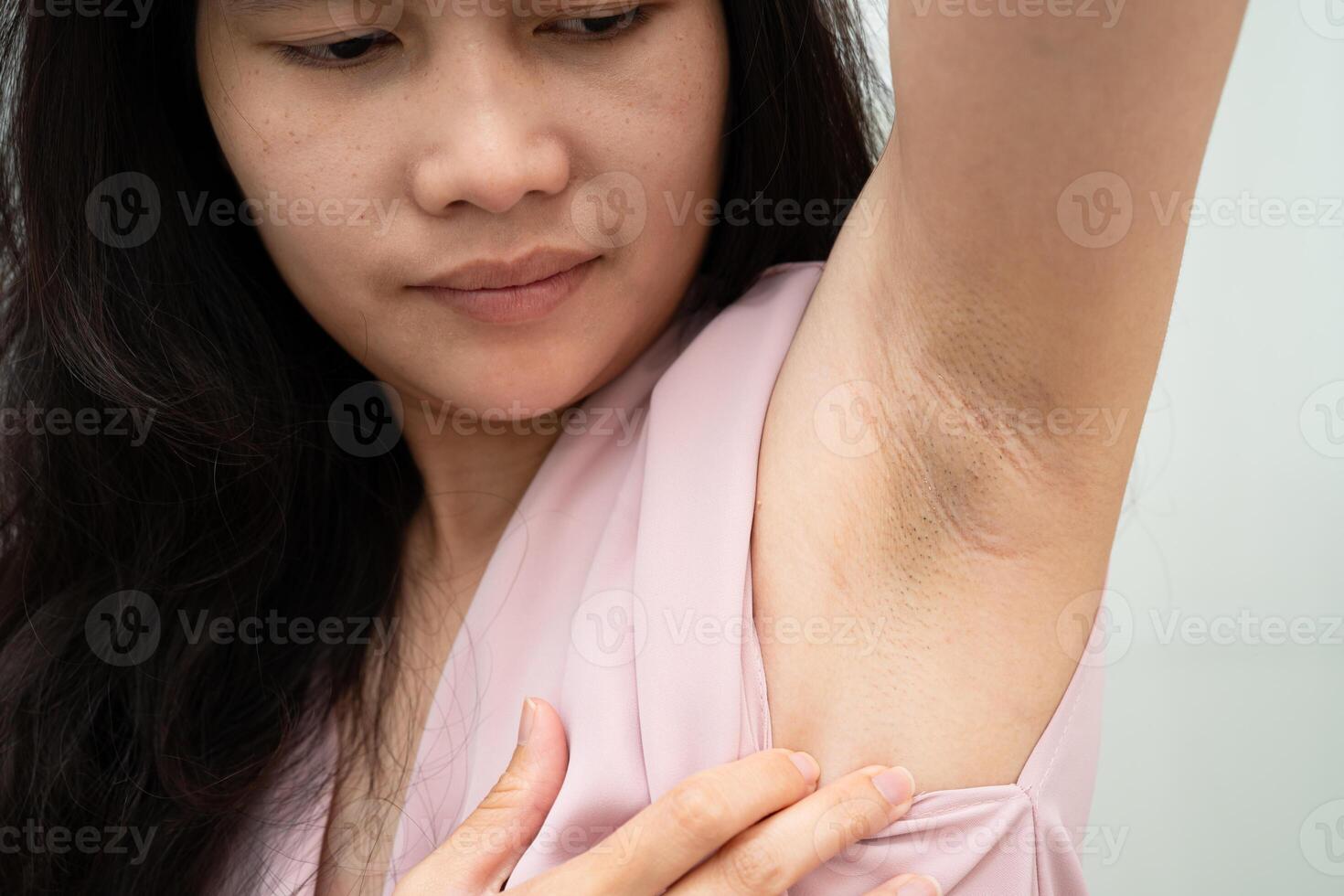 Asian woman have problem black armpit beauty skin photo