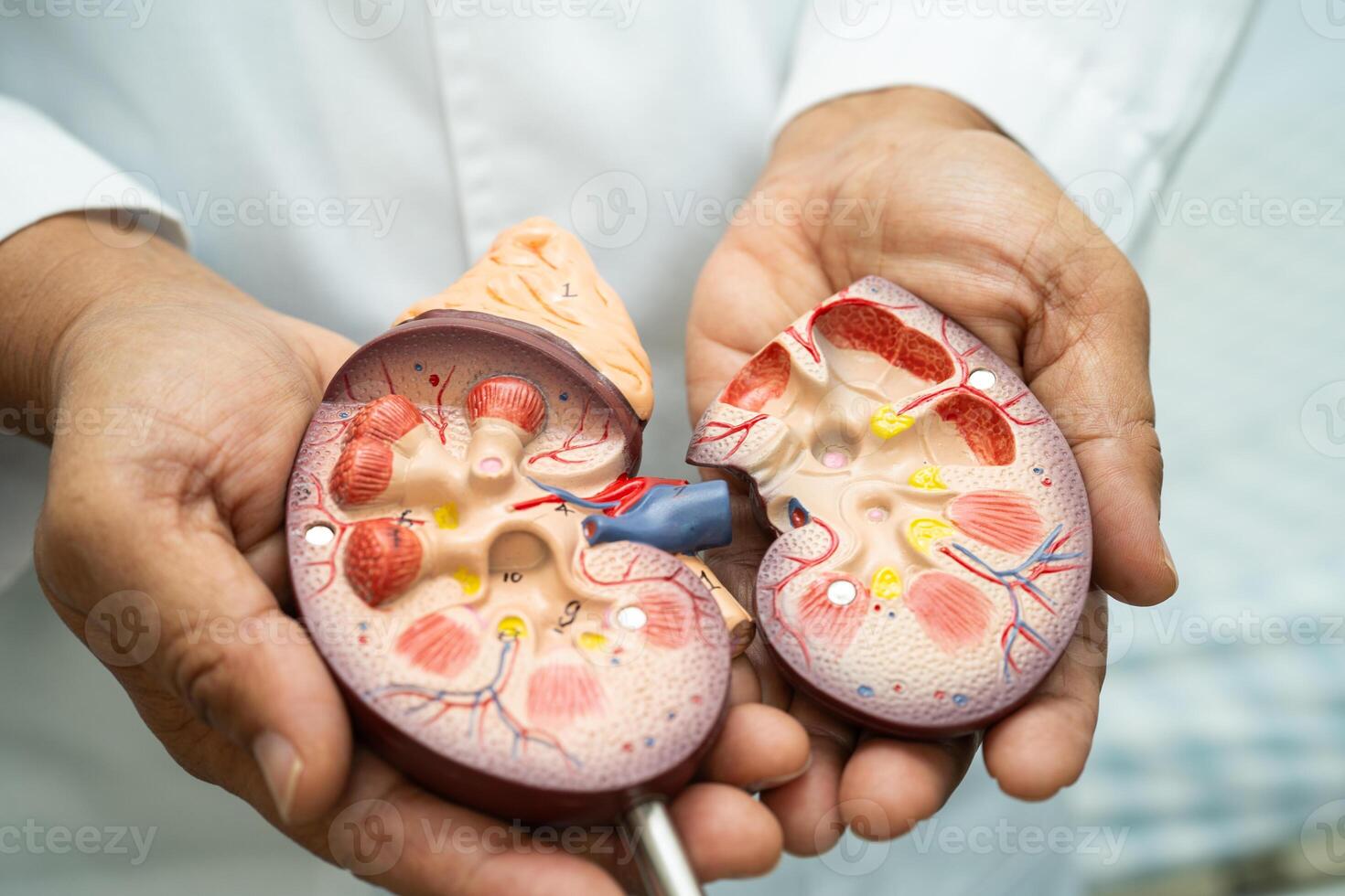 Kidney disease Chronic kidney disease ckd, Doctor photo