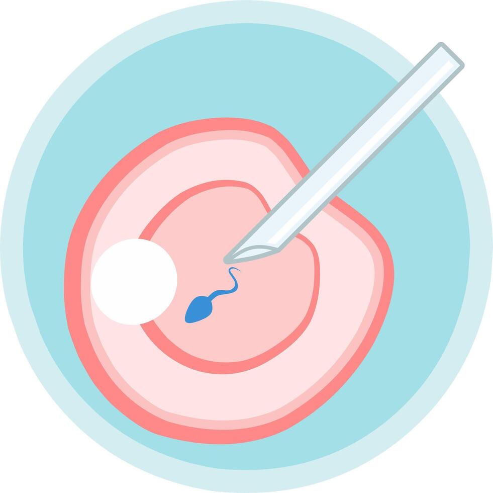 IVF ICSI simple llustration. Perfect for presenting anything about reproduction, insemination or ivf. Vertical position with blue background. vector