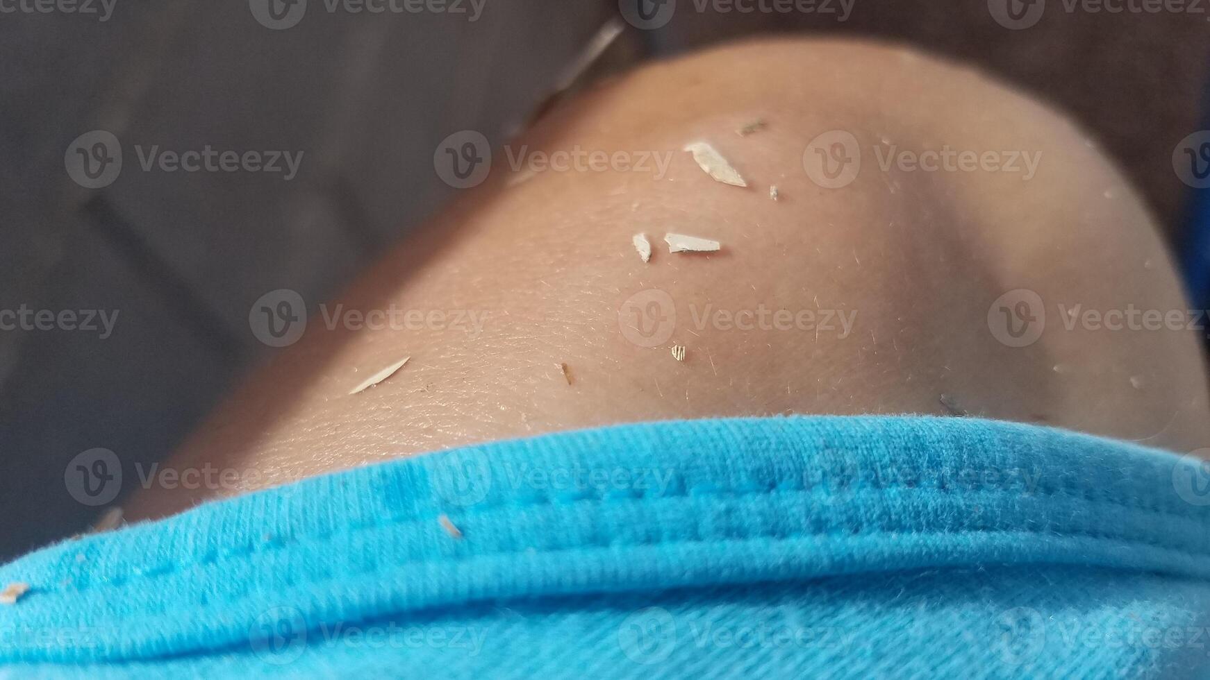 Paint Chips on Bare Shoulder, Female Working on Home Improvement photo