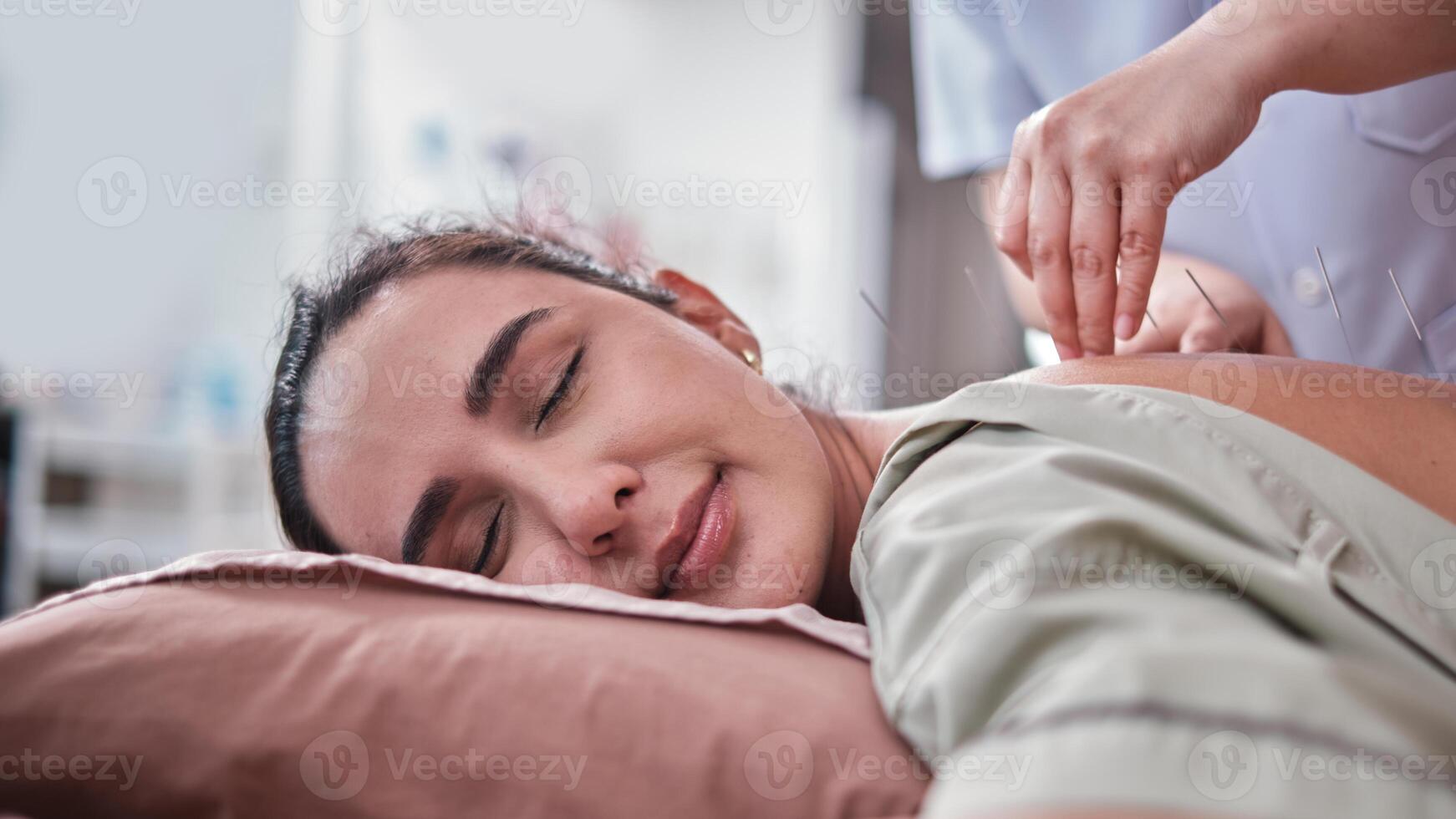 Oriental healing, Hispanic woman patient with acupuncture treatment on back by Asian physio therapist for muscle pain relief, passive medical therapy at healthcare wellness spa in hospital clinic. photo