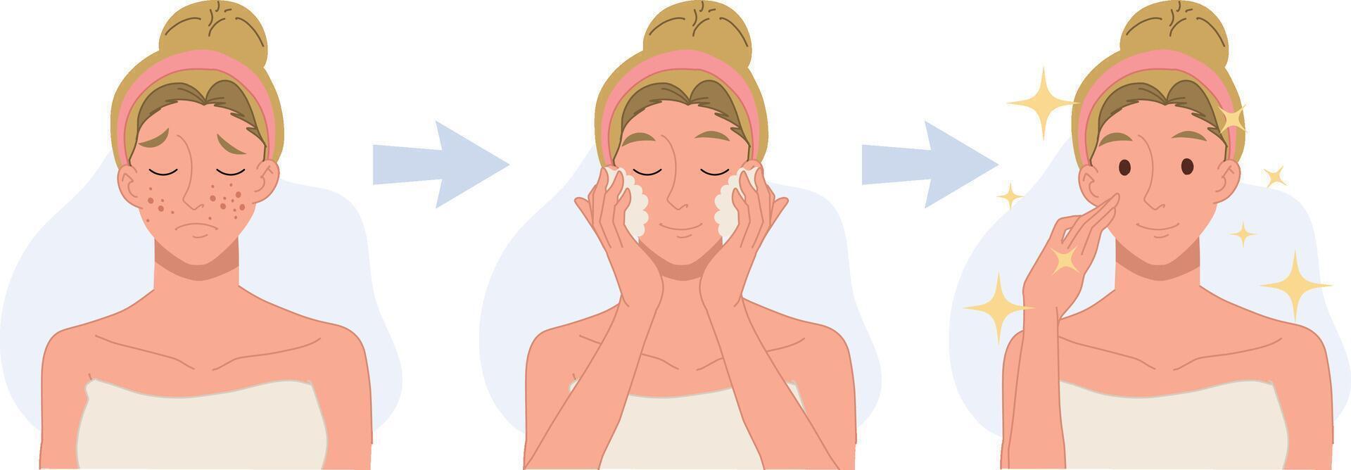 treat acne, skin problem,pimple .woman face.Beautiful.before after,step cleansing face. Flat 2d cartoon character illustration. vector